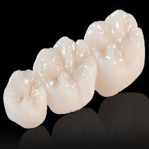 Cerâmica dental