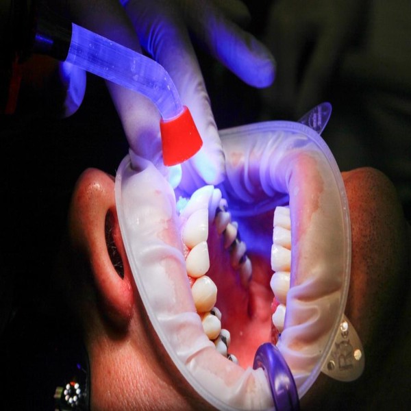 Lâmpada UV esterilização de dentista