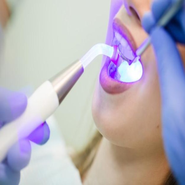 Valor da lâmpada UV consultórios de dentista