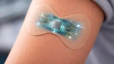 Curativo inteligente monitora feridas em tempo real 5 Curativo inteligente monitora feridas em tempo real