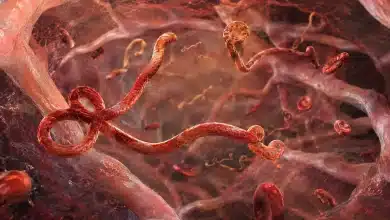Surto de Ebola na África Central preocupa OMS 5 Surto de Ebola na África Central preocupa OMS