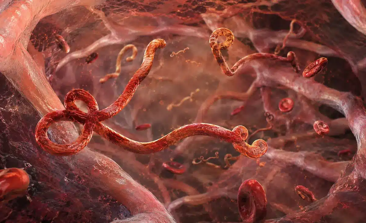 Surto de Ebola na África Central preocupa OMS 2 Surto de Ebola na África Central preocupa OMS
