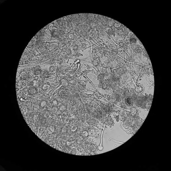 Ensaio De Macrografia