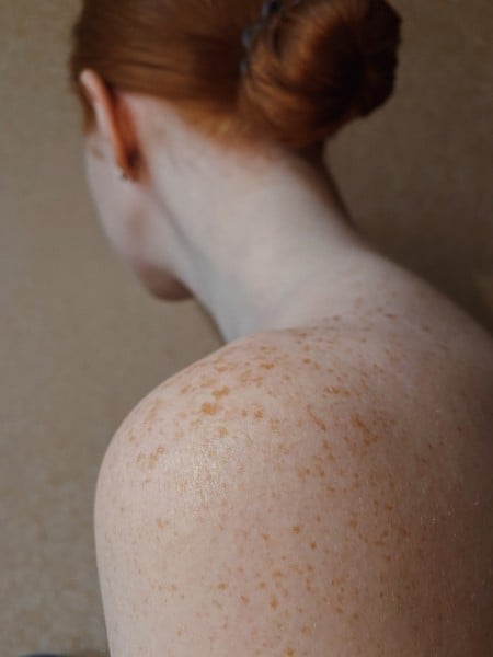 Base Cosmética Para Clarear Manchas